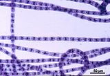 6 - Dettaglio dei filamenti colorati con blu di toluidina